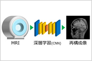 ［プレスリリース］深層学習を活用したMRIの撮影時間の高速化と高品質化