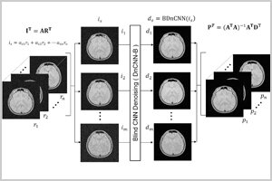 ［プレスリリース］深層学習を利用した新たなMRI画像向け雑音除去法を提案