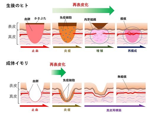 生後のヒトと成体イモリの皮膚創傷治癒様式の比較